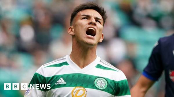 Celtic player pleads guilty to drink driving