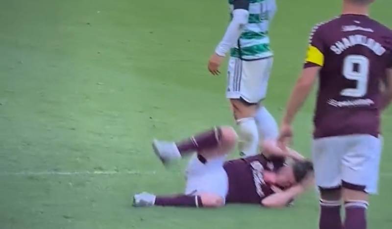Watch: The Incident The SMSM Refuse To Talk About In Hearts v Celtic Game