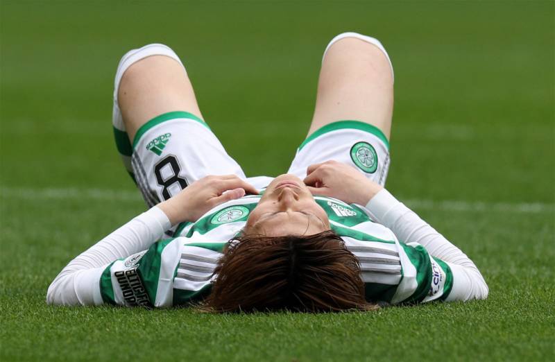Celtic Drop Points On An Afternoon Where Hibs Offered Nothing Worthy Of Praise.