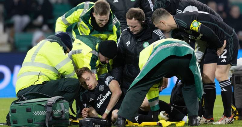 Alistair Johnston suffers nasty Celtic injury as defender stretchered off against Hibs
