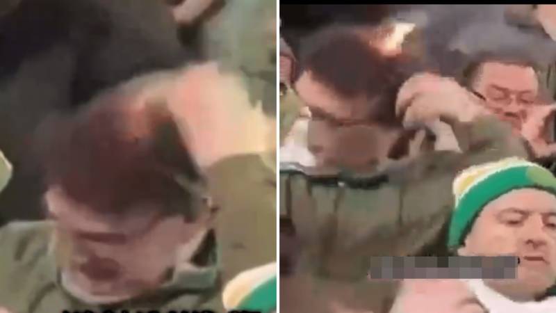 Shocking moment Celtic fan’s hair set on FIRE after wild pyro display at Hibs game