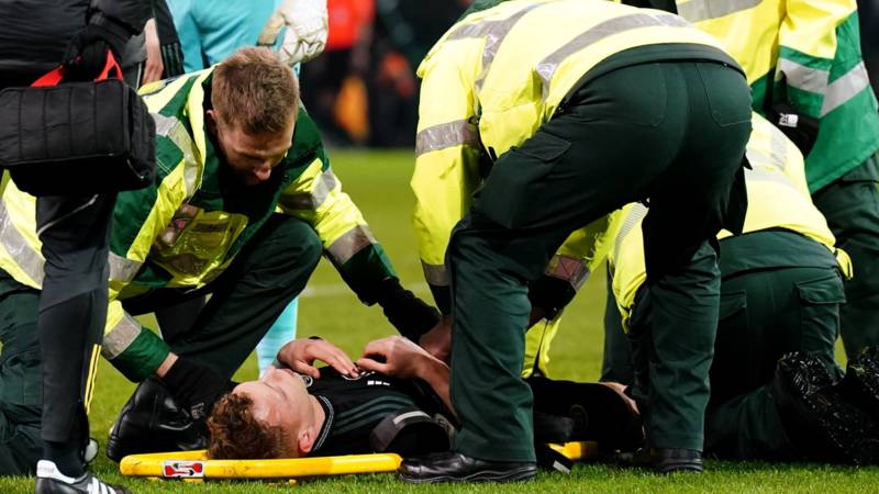 Celtic fear Johnston has suffered head fracture