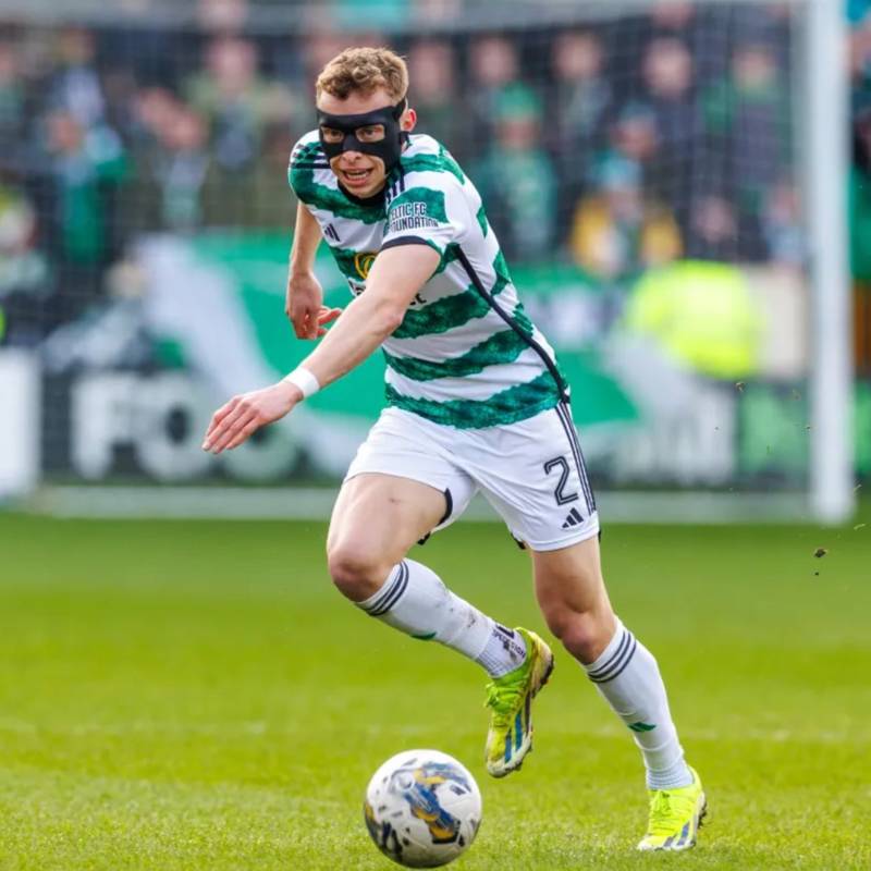 “It’s About Seeing Those Pictures and Playing Forward Without Being Risk Adverse” – Celtic Star Looks Ahead To Dundee Challenge