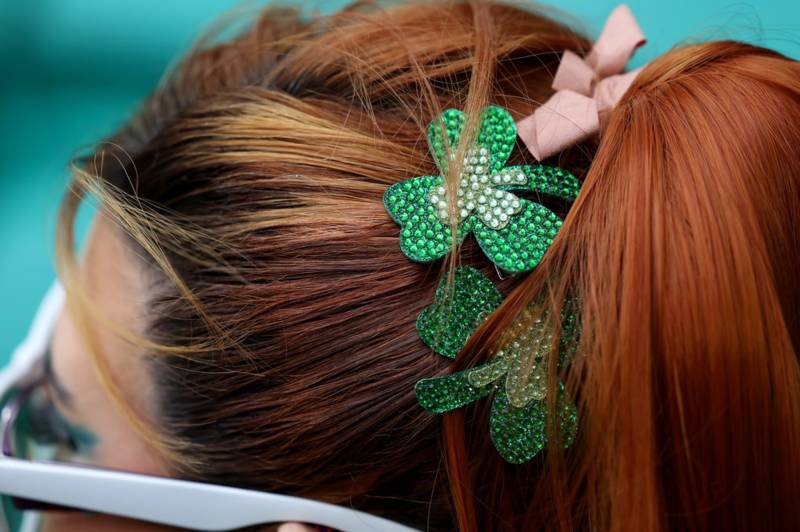 The Celts are Hair – Lovely photos from Celtic v Livingston