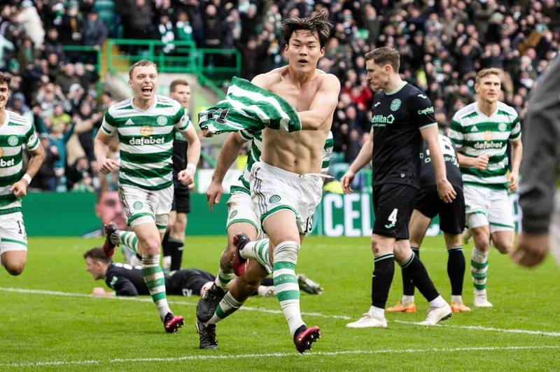 Celtic’s Win Over Hibs Turns Bonkers – Two Weeks’ Wages, Ban For ...