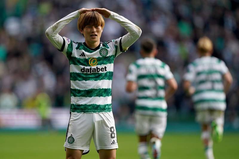 Celtic talisman Kyogo Furuhashi left pitch to have shoulder popped back into place as Brendan Rodgers quizzed over fitness for Feyenoord